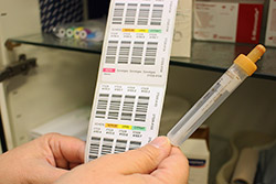 HIV-Testset