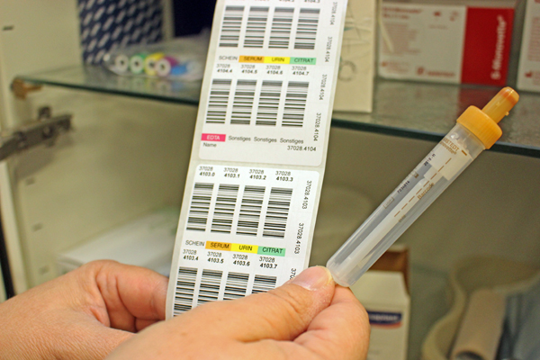 ein Serumröhrchen, in das beim HIV-Test das Blut gezogen wird, und Etiketten für die Proben