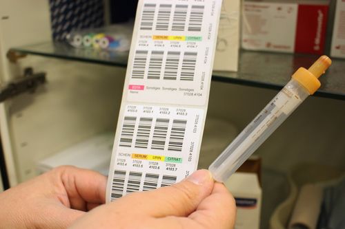 ein Serumröhrchen, in das beim HIV-Test das Blut gezogen wird, und Etiketten für die Proben
